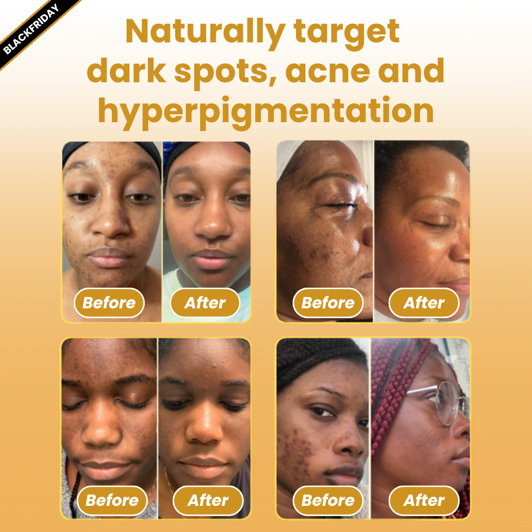 Kojic Acid Turmeric Anti-Spot Overnight Mask