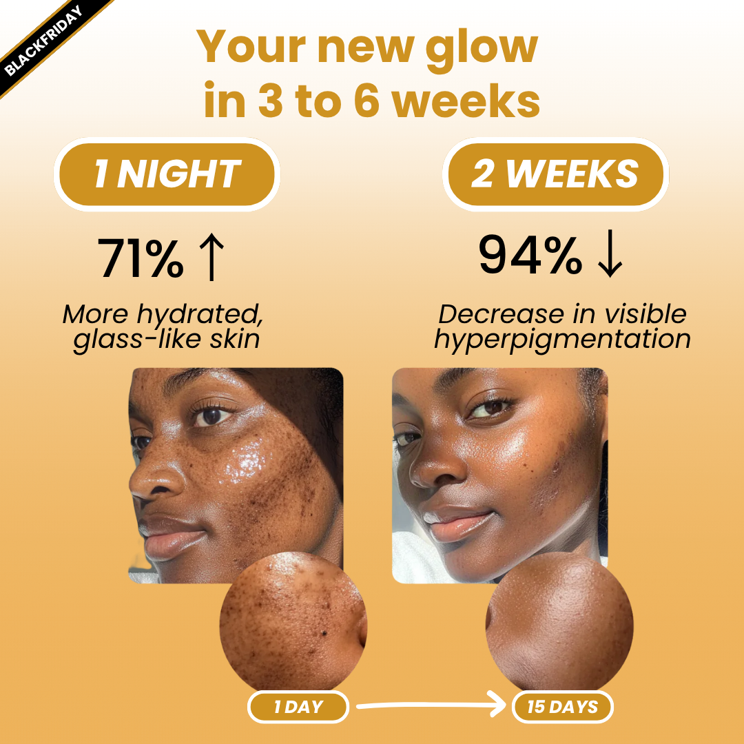Kojic Acid Turmeric Anti-Spot Overnight Mask